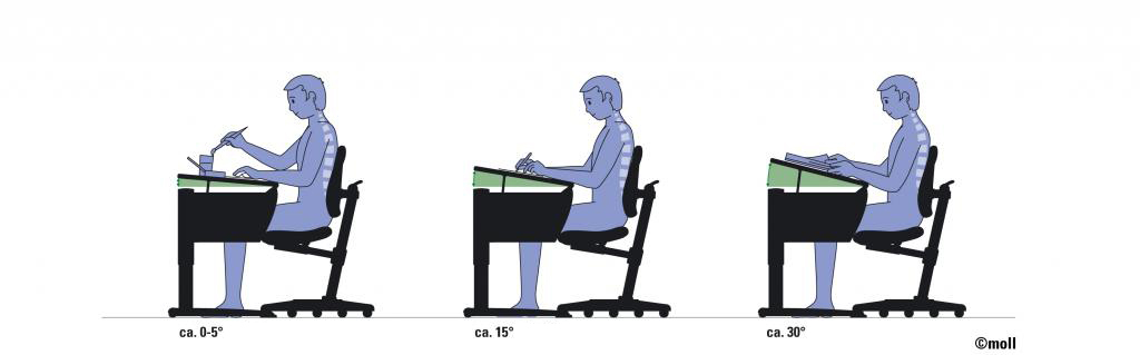 How to fix a child's posture? Causes of violation of posture in children of school and preschool age