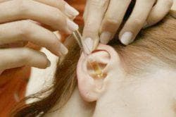 ear instillation