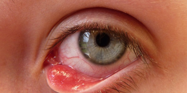 Emoksi optiker vil bidra til å gjenopprette øyevæv