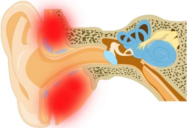 Mastoïditis: kenmerken, symptomen, behandelkenmerken en prognose