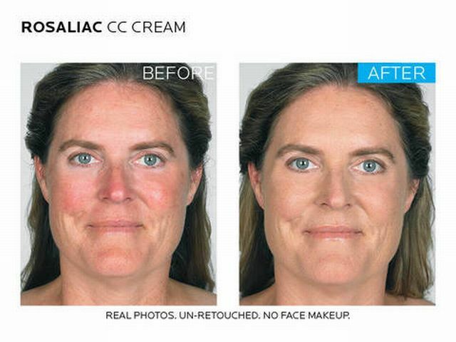 before and after applying the cream