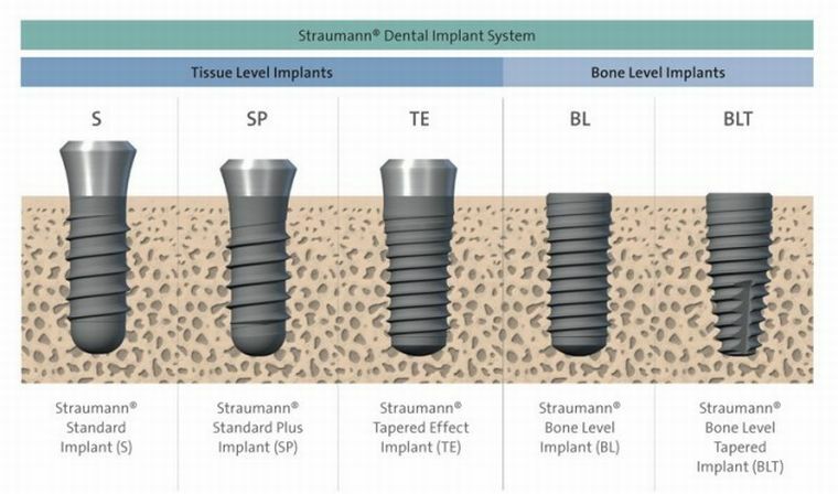 Implantáty Straumann - švýcarská kvalita, spolehlivost a jednoduchost