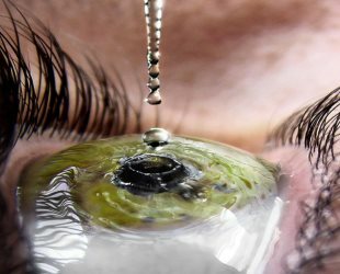 Beskrivning av ett frekvent fenomen - blödning i ögat