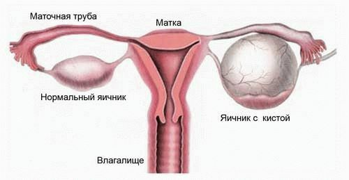 Neoplasia ou origem da vida