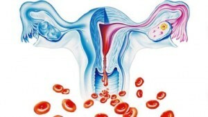 Anemia in menstruation 10