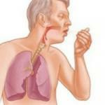 kako zdraviti obstruktivni bronhitis doma