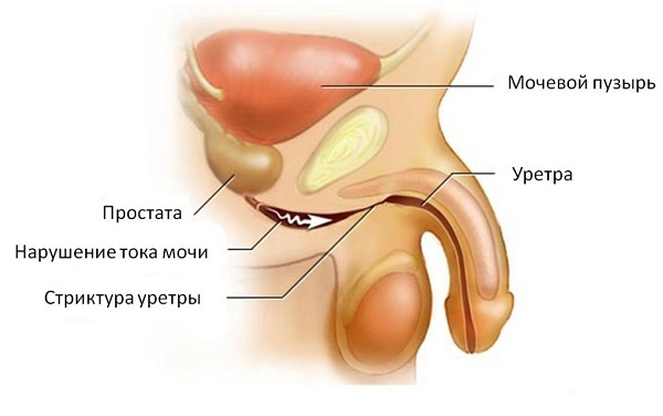 Utflod fra urinrøret hos menn