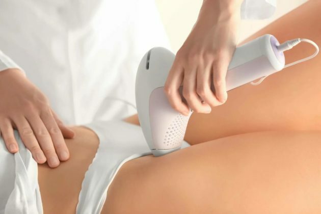 Is it possible to do laser hair removal for uterine fibroids