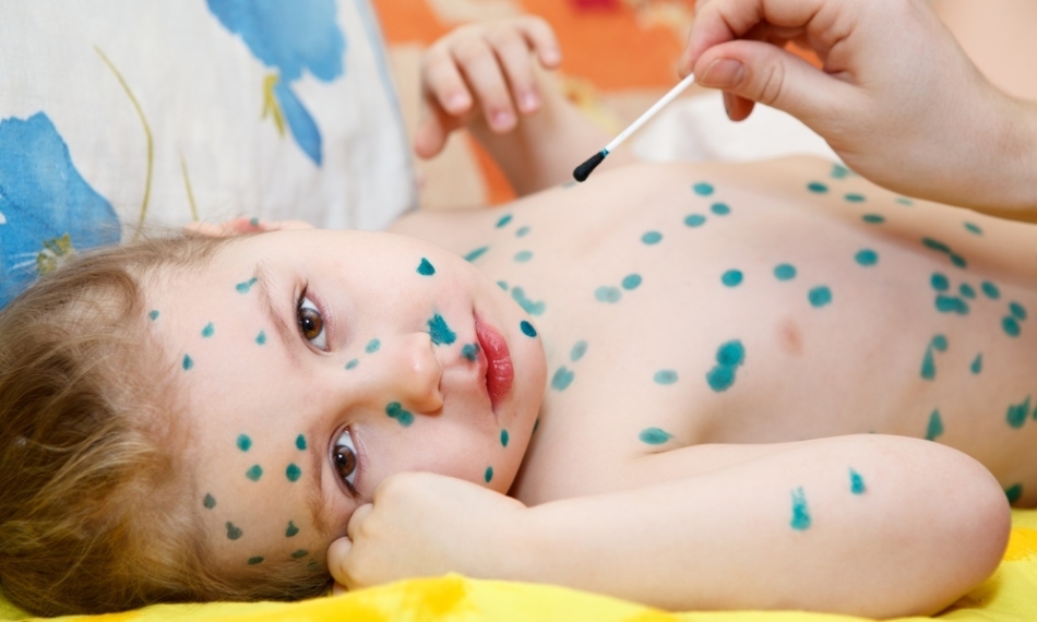 Stains and rashes on the face and body of the child: red, brown, white: causes and treatment