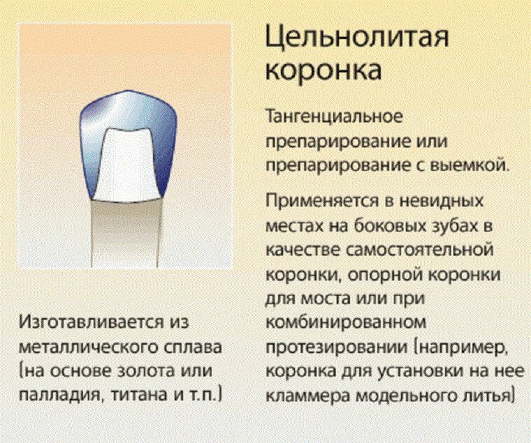 Pilnas kronas - mūsdienīga zobu atjaunošanas metode