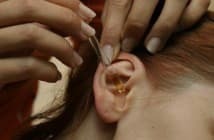 treatment of otitis in children under one year of age