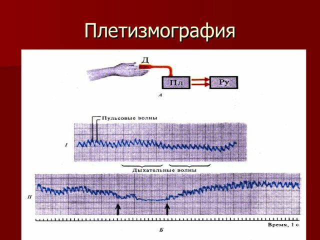 Pletismografia: método de estudo do tom vascular e fluxo sanguíneo