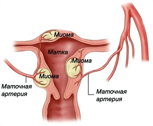 Apa yang akan ditunjukkan oleh gumpalan besar saat menstruasi?