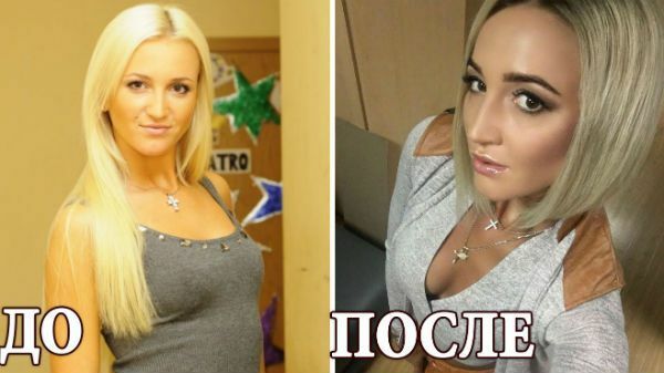 Aktorka i prezenterka Olga Buzova - zdjęcia przed i po tworzywach sztucznych