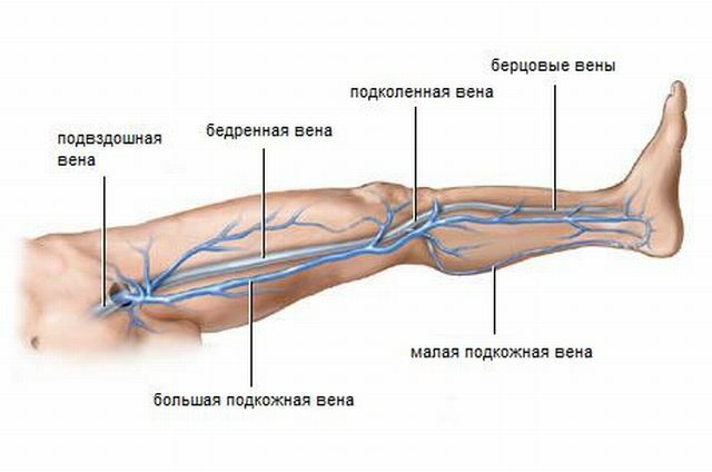 Ockupation av vener på benen: Karakteristiska symtom och behandling