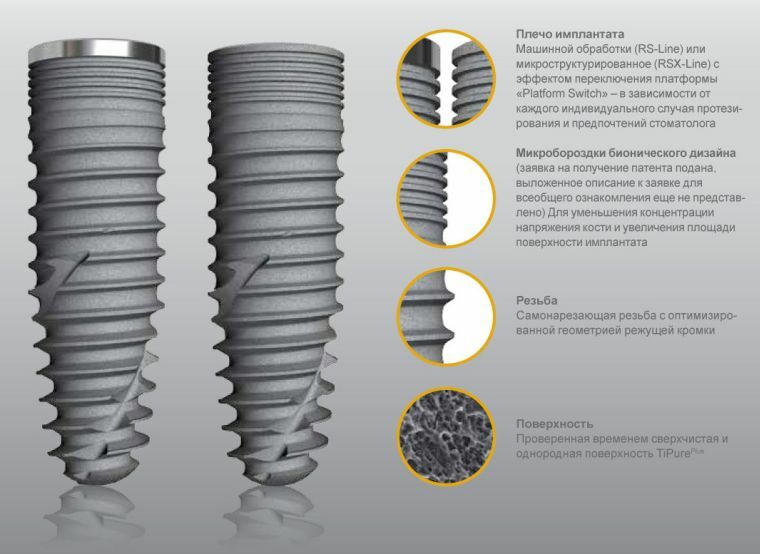 Implantes Semados - uma escolha ditada pela qualidade e pelo tempo