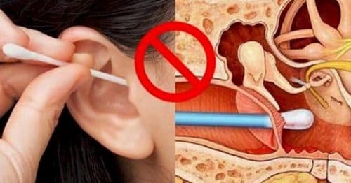 poškození sluchu ucha