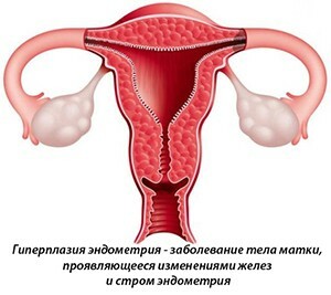 Nomeação de Duphaston na menopausa