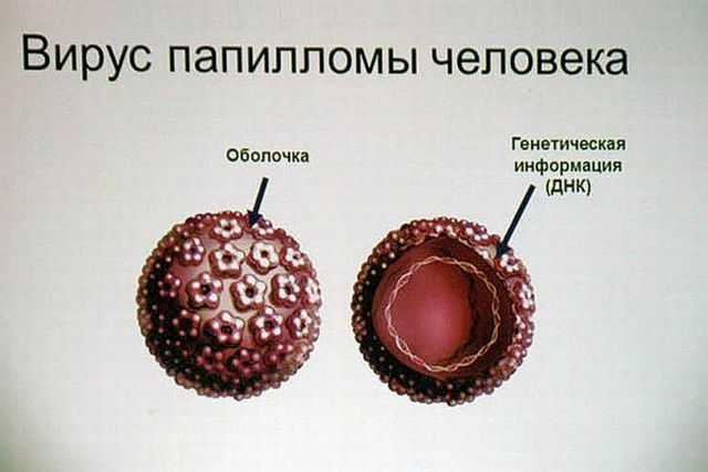 Papilomos anuliae yra nekenksmingi augalai ar pavojus?