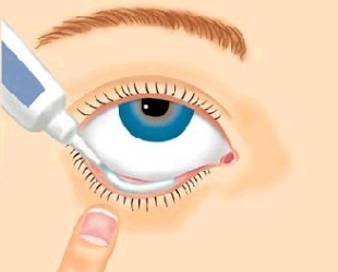 Uso de pomada de eritromicina para tratamento ocular