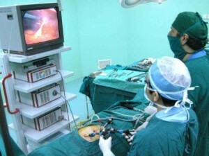 Postoperative period with laparoscopy ovarian cysts