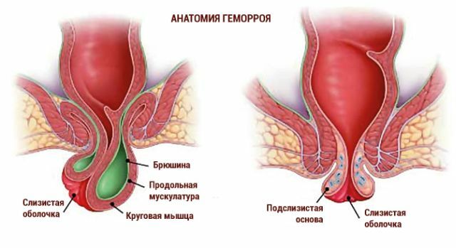 Hemorojaus anatomija