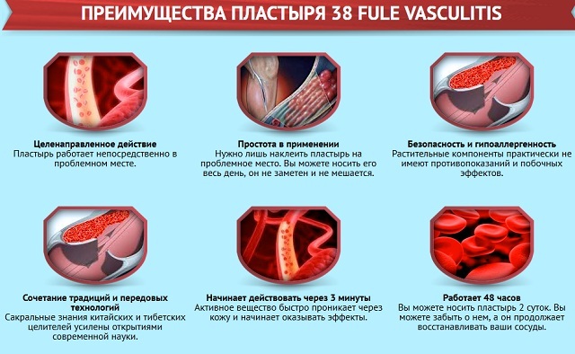 Kitajski omet 38 Fule Vasculitis bo razbremenil krčne žile in vaskulitis