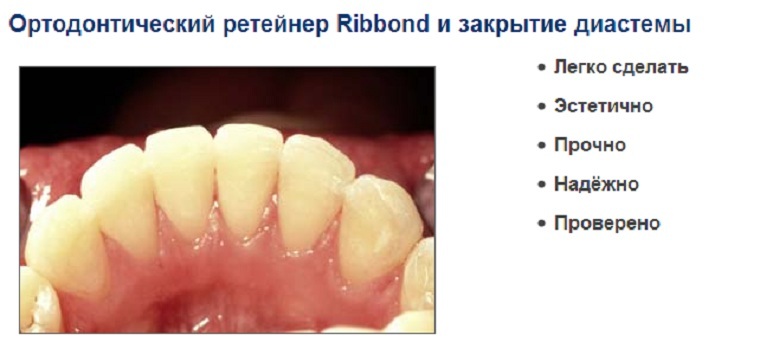 O uso de fita de fita de reforço para dentes de furação