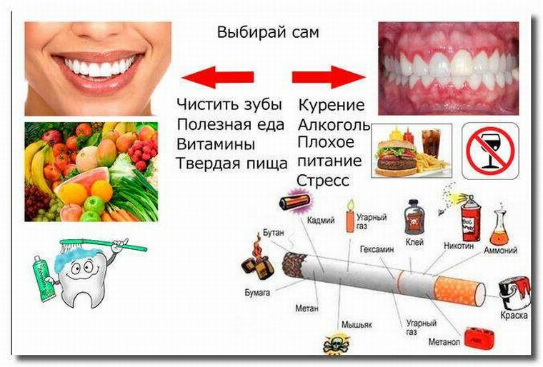 Mencegah periodontitis - bagaimana cara menghindari penyakit periodontal?