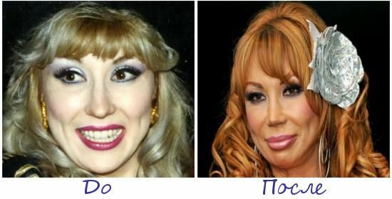 Victims of Plastic Surgery