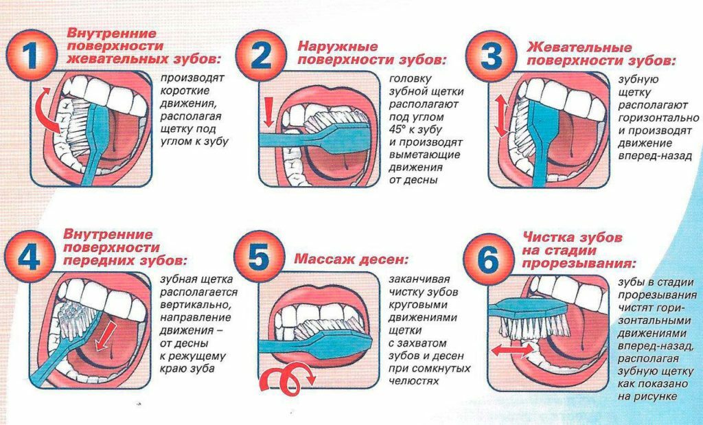 Coloque odontoklazii na classificação de cáries, diagnóstico e tratamento