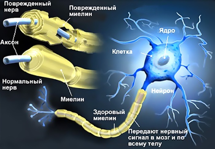 Mais sobre neurite óptica