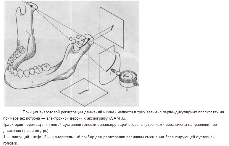 Axiografia como método de análise e registro dos movimentos da mandíbula inferior