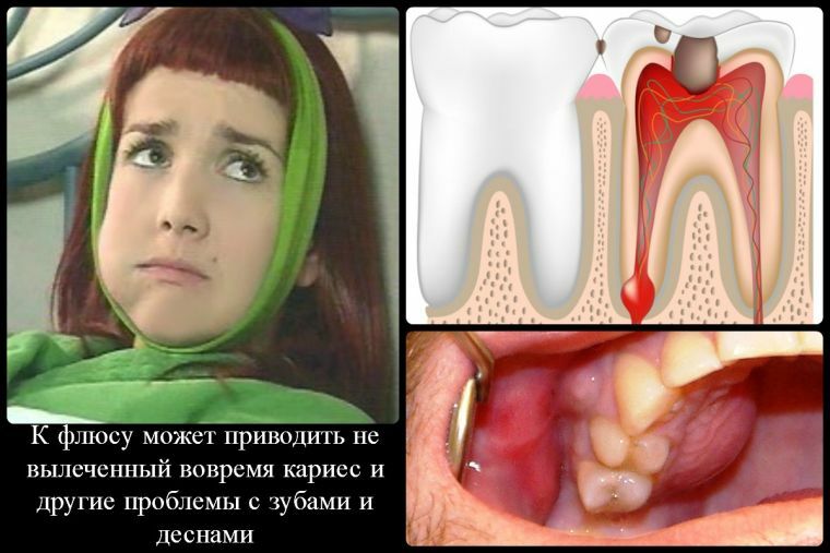 O que é dente dentário: informações básicas sobre as causas, sinais e tratamento