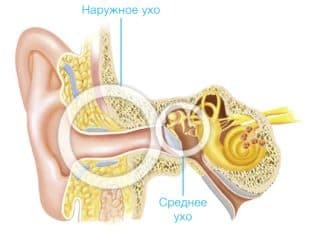 bilateral conductive hearing loss