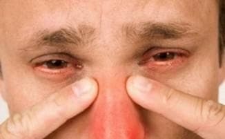 Sinusitis berbahaya bagi kehidupan