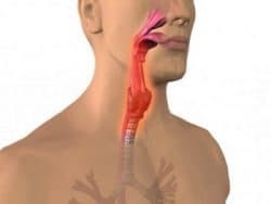 granulosa pharyngitis in an adult