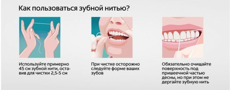 Como usar o fio dental: complete as instruções